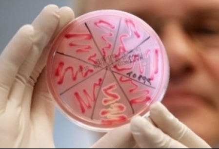 Epidemia E.coli, intre prezumtie si adevar